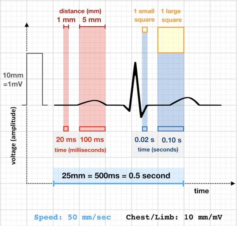 Kecepatan Kerta EKG 50mm/detik