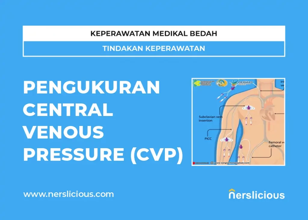 Pengukuran Central Venous Pressure